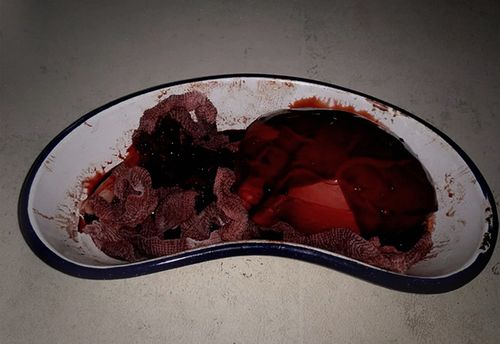 Blood & Organs