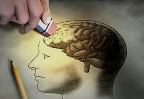 Memory Lapse
