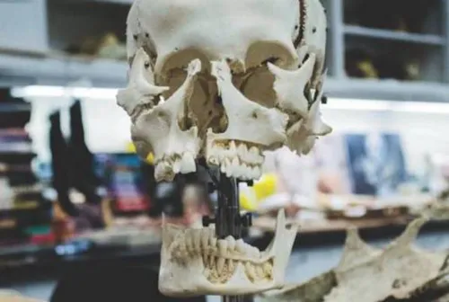Autopsy